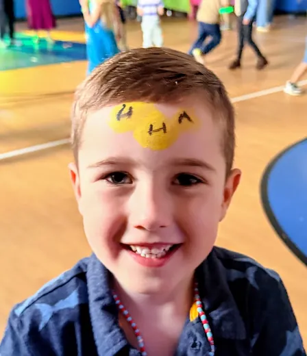 An HHA bee on the forehead